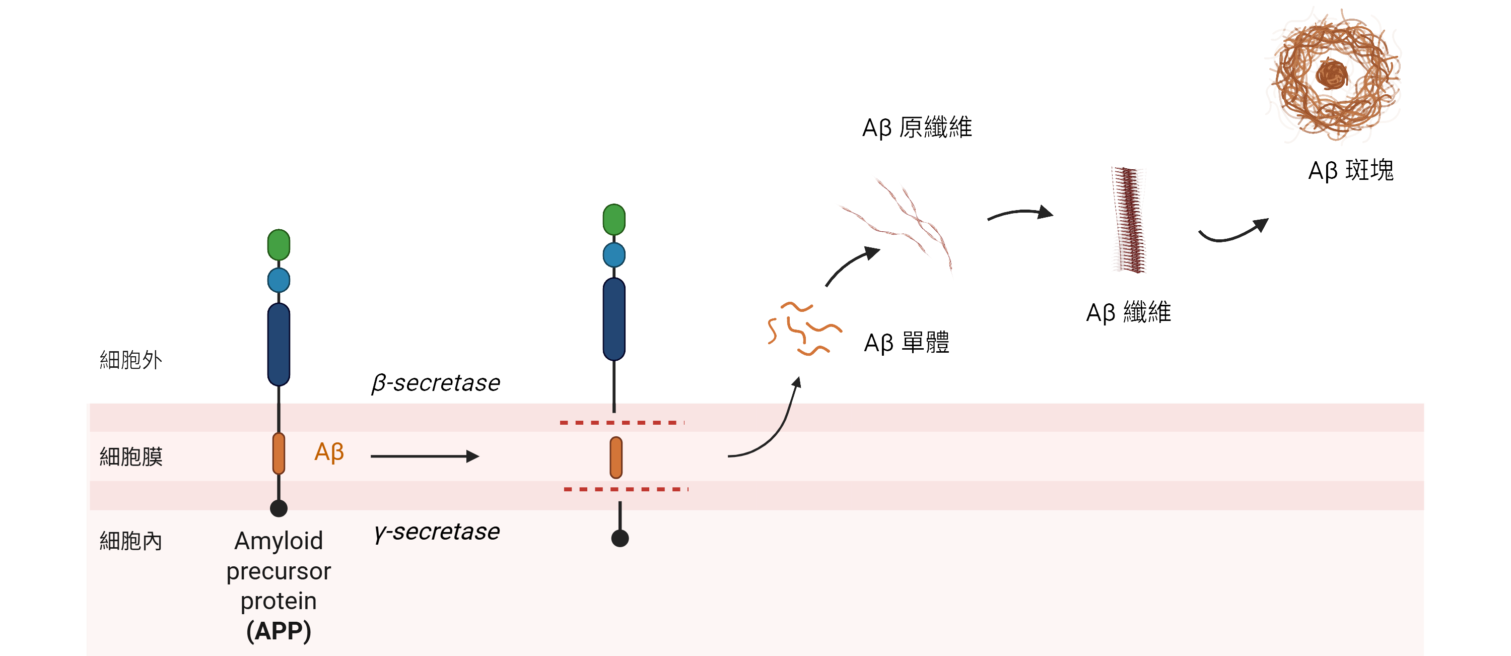 Amyloid plaque formation diagram